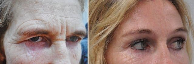 Resultaat foto 6